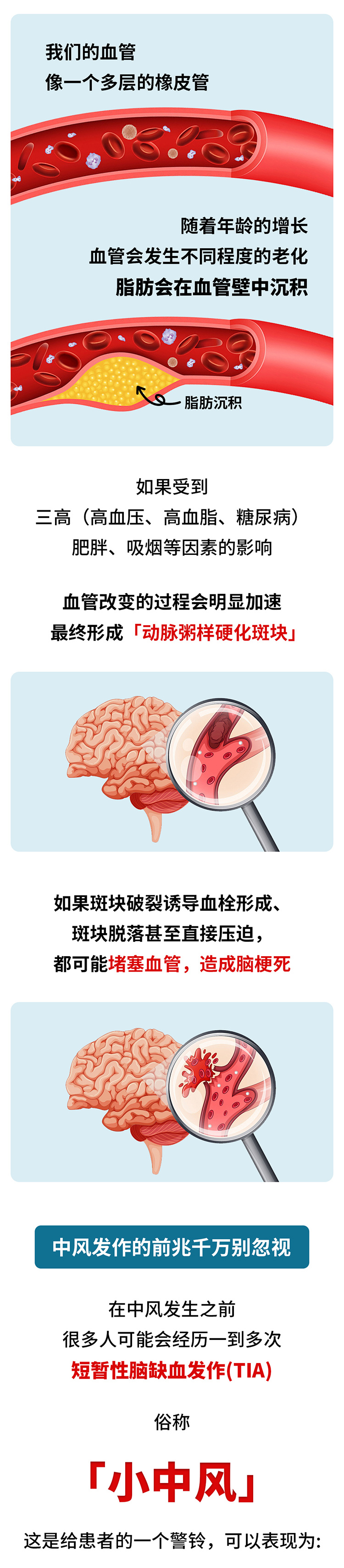 中風的5個前兆，盡早發(fā)現(xiàn)能救命_02.jpg